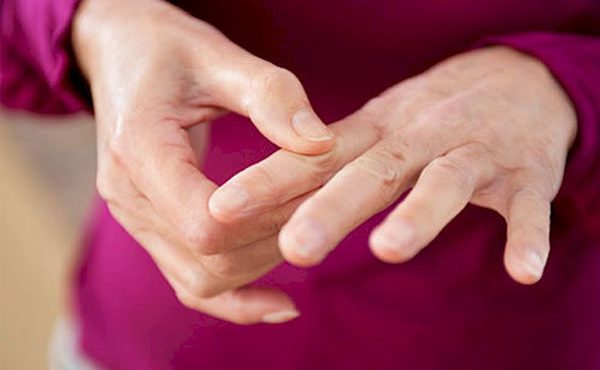 تاثیر داروی درمان آرتریت روماتوئید در پیشگیری از بیماری