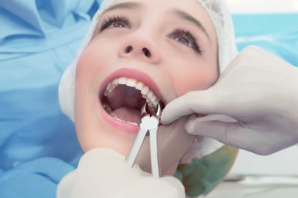 دندانپزشک در حال کشیدن دندان ششم بیمار